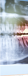 Color enhanced digital dental x-ray