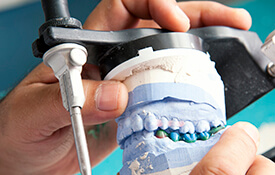 Model of teeth and dental restoration