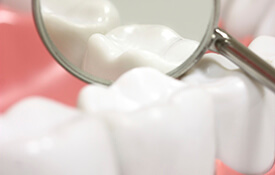 Teeth enlarged in dental examination mirror