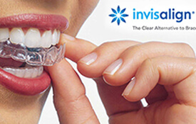 Closeup of patient inserting Invisalign tray